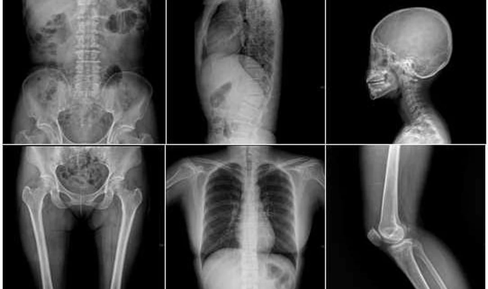 ¿Qué son los Rayos X y para qué se usan?